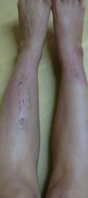 20100711792.jpg